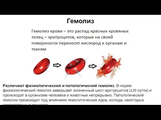 Гемолиз Различают физиологический и патологический гемолиз. В норме физиологический гемолиз завершает