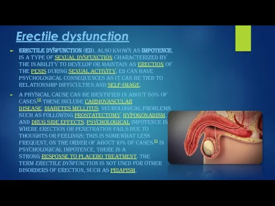 Erectile dysfunction Erectile dysfunction (ED), also known as impotence, is a