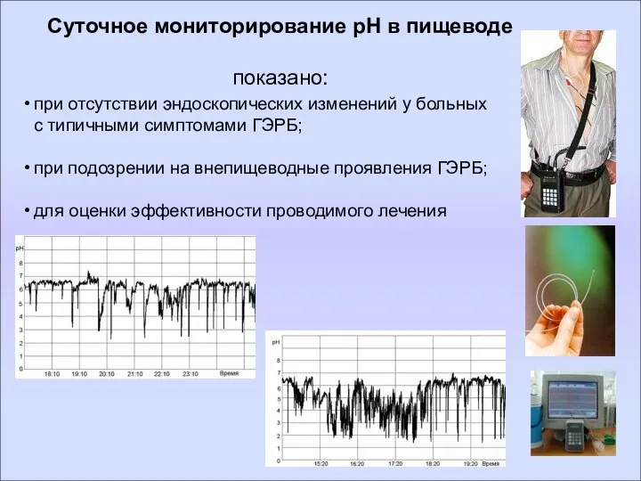 Суточное мониторирование рН в пищеводе показано: при отсутствии эндоскопических изменений у