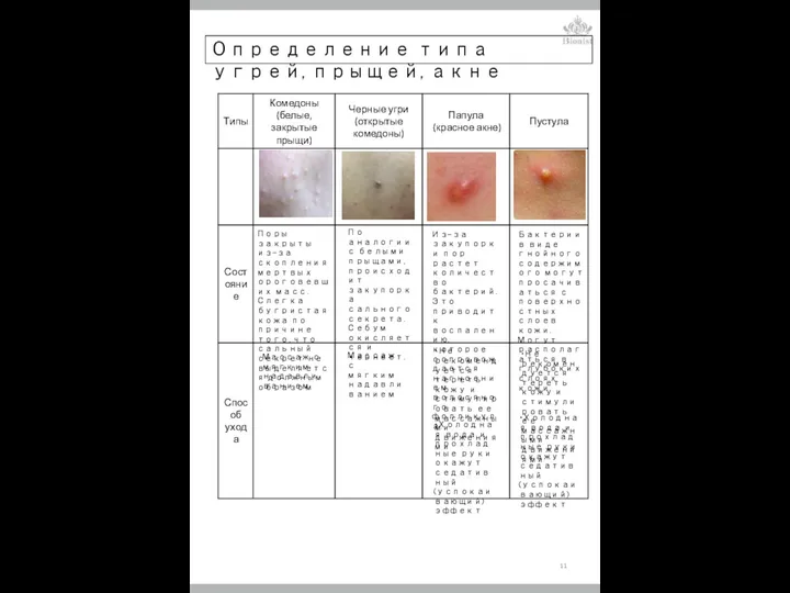 Определение типа угрей, прыщей, акне Поры закрыты из-за скопления мертвых ороговевших