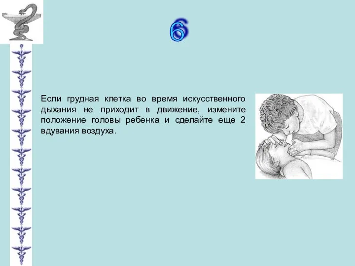 6 Если грудная клетка во время искусственного дыхания не приходит в