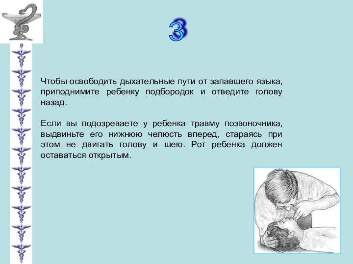 3 Чтобы освободить дыхательные пути от запавшего языка, приподнимите ребенку подбородок