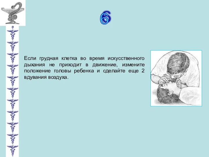 6 Если грудная клетка во время искусственного дыхания не приходит в