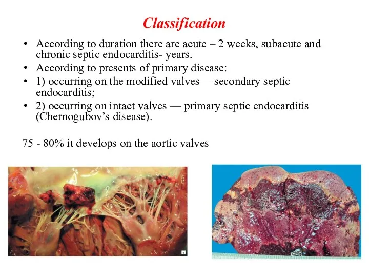 Classification According to duration there are acute – 2 weeks, subacute