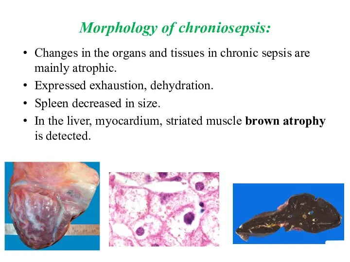 Morphology of chroniosepsis: Changes in the organs and tissues in chronic