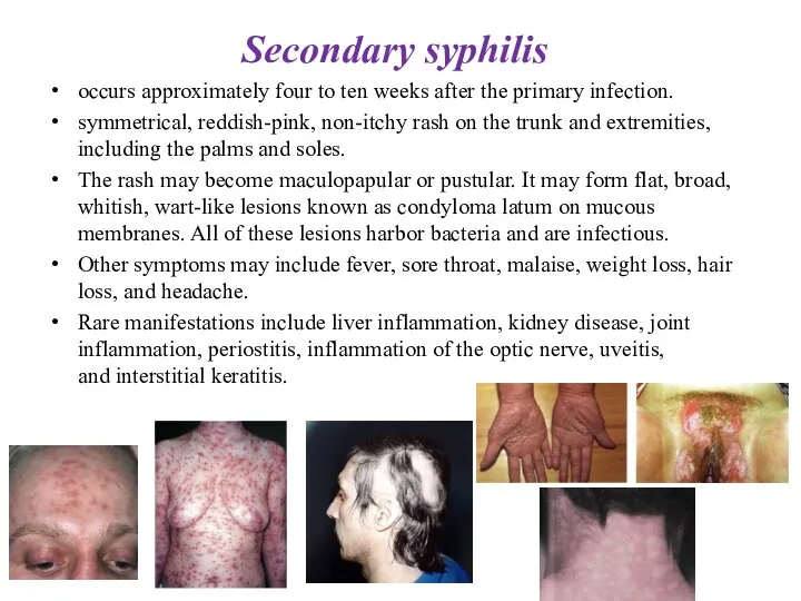 Secondary syphilis occurs approximately four to ten weeks after the primary