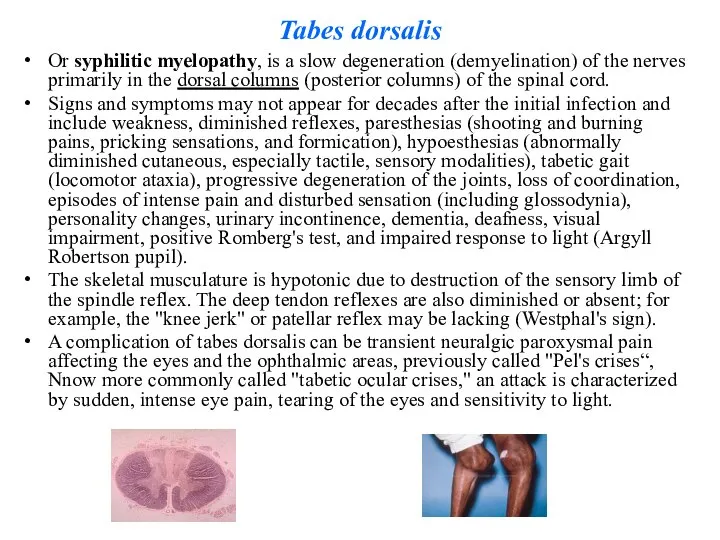 Tabes dorsalis Or syphilitic myelopathy, is a slow degeneration (demyelination) of