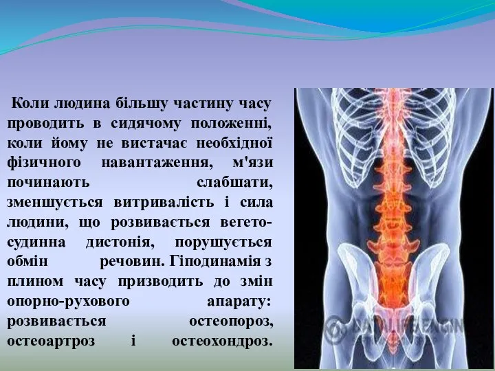 Коли людина більшу частину часу проводить в сидячому положенні, коли йому