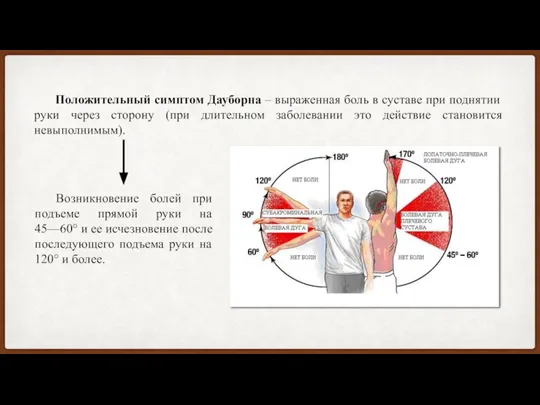 Положительный симптом Дауборна – выраженная боль в суставе при поднятии руки