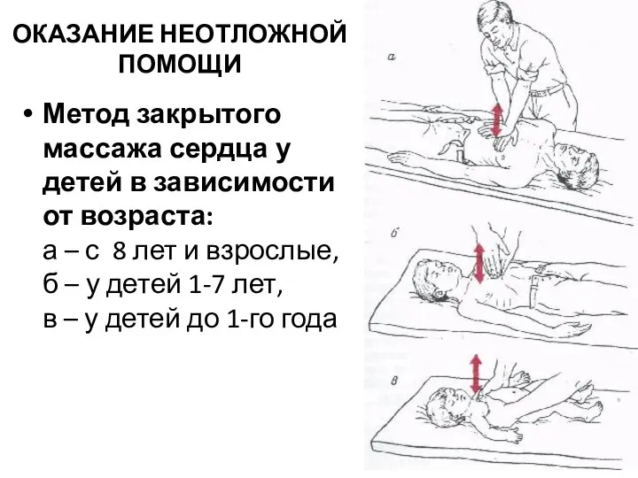 ОКАЗАНИЕ НЕОТЛОЖНОЙ ПОМОЩИ Метод закрытого массажа сердца у детей в зависимости