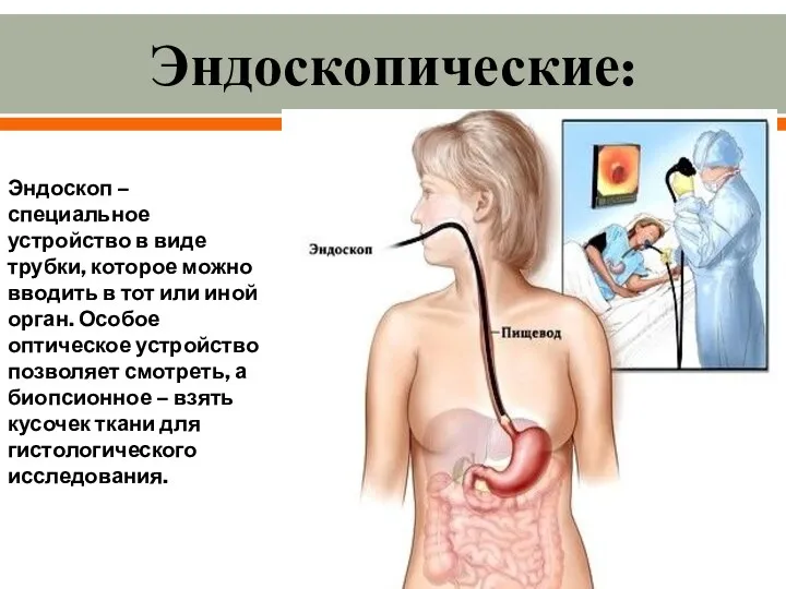 Эндоскопические: Эндоскоп – специальное устройство в виде трубки, которое можно вводить