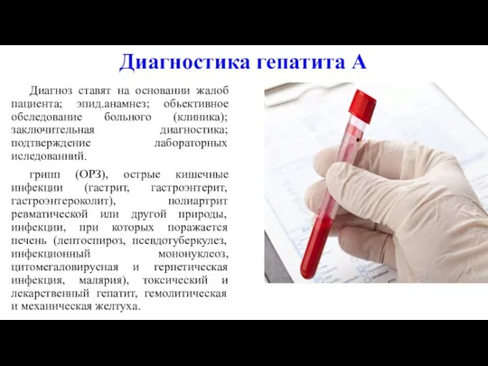 Диагностика гепатита А Диагноз ставят на основании жалоб пациента; эпид.анамнез; обьективное