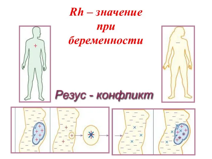 Резус - конфликт Rh – значение при беременности