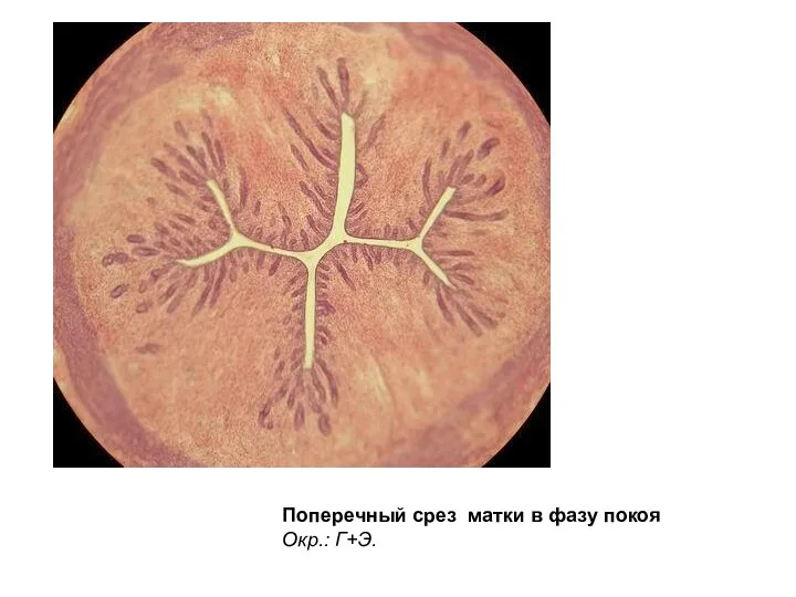 Поперечный срез матки в фазу покоя Окр.: Г+Э.