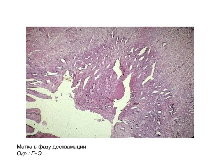 Матка в фазу десквамации Окр.: Г+Э.
