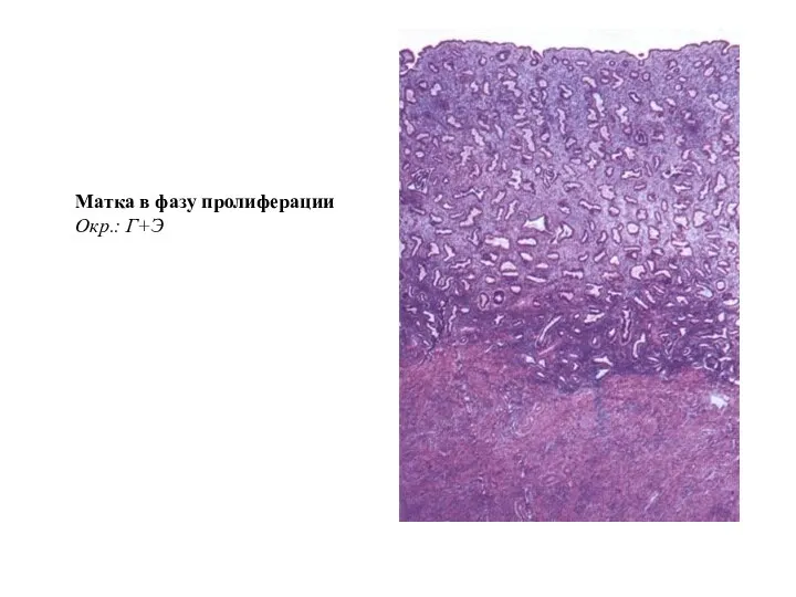 Матка в фазу пролиферации Окр.: Г+Э