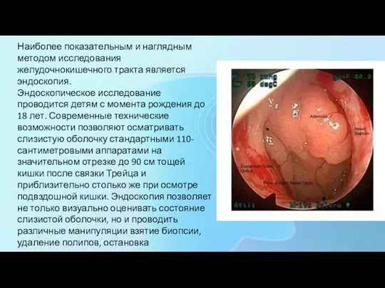 Наиболее показательным и наглядным методом исследования желудочнокишечного тракта является эндоскопия. Эндоскопическое