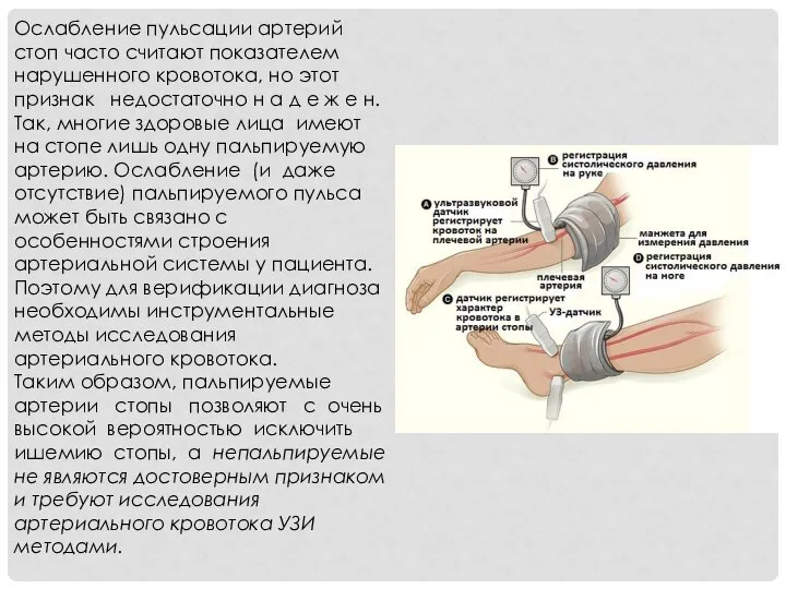 Ослабление пульсации артерий стоп часто считают показателем нарушенного кровотока, но этот