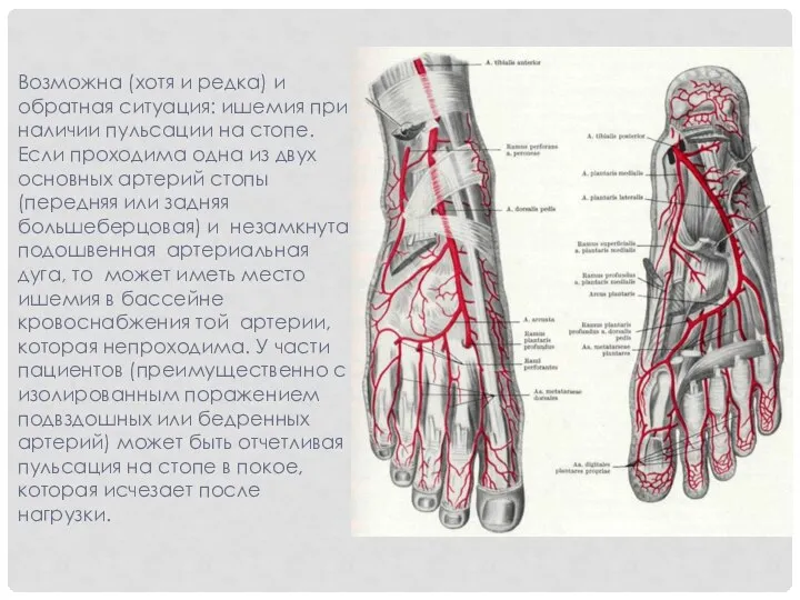 Возможна (хотя и редка) и обратная ситуация: ишемия при наличии пульсации