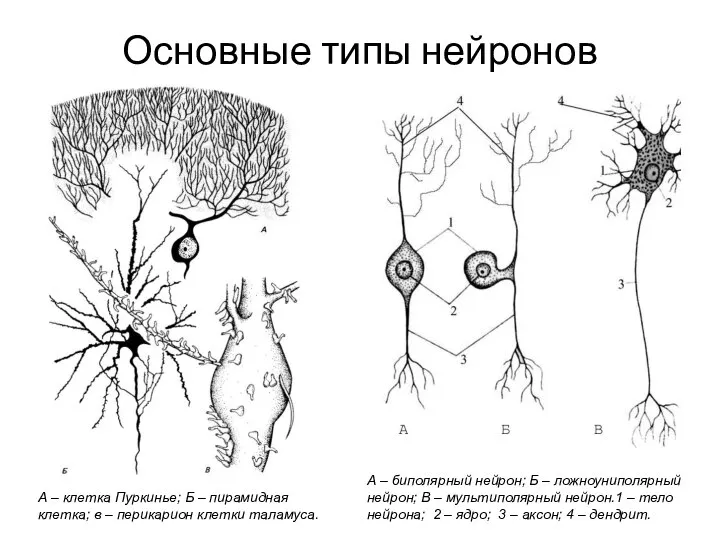 А – биполярный нейрон; Б – ложноуниполярный нейрон; В – мультиполярный