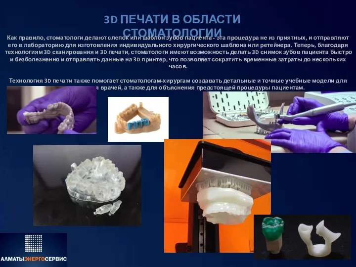 3D ПЕЧАТИ В ОБЛАСТИ СТОМАТОЛОГИИ Как правило, стоматологи делают слепок или