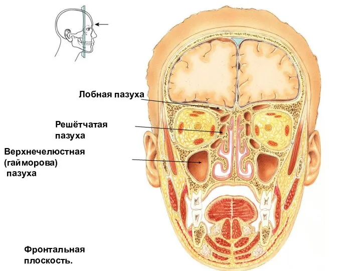Лобная пазуха Решётчатая пазуха Верхнечелюстная (гайморова) пазуха Фронтальная плоскость.