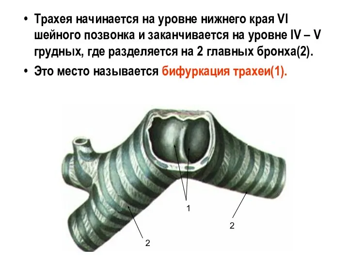 Трахея начинается на уровне нижнего края VI шейного позвонка и заканчивается