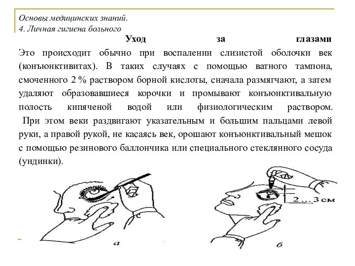 Уход за глазами Это происходит обычно при воспалении слизистой оболочки век