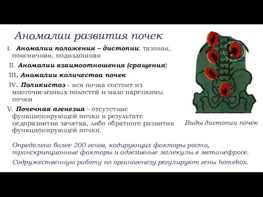 Аномалии развития почек I. Аномалии положения – дистопии: тазовая, поясничная, подвздошная