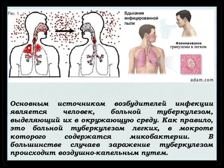 Основным источником возбудителей инфекции является человек, больной туберкулезом, выделяющий их в