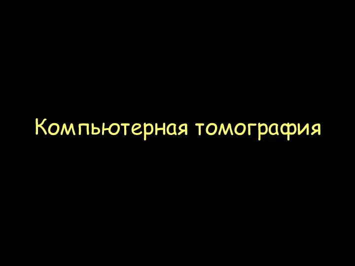 Компьютерная томография