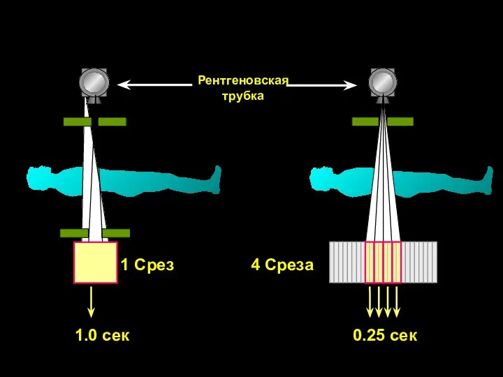 4 Среза 1 Срез Рентгеновская трубка