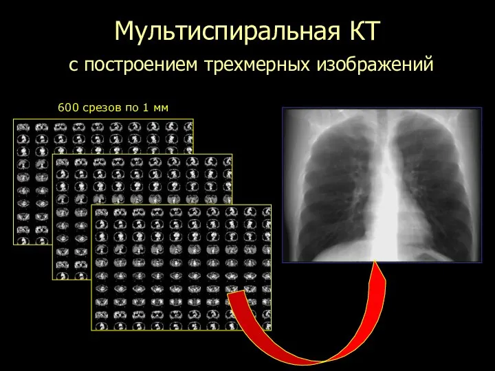 600 срезов по 1 мм Мультиспиральная КТ с построением трехмерных изображений