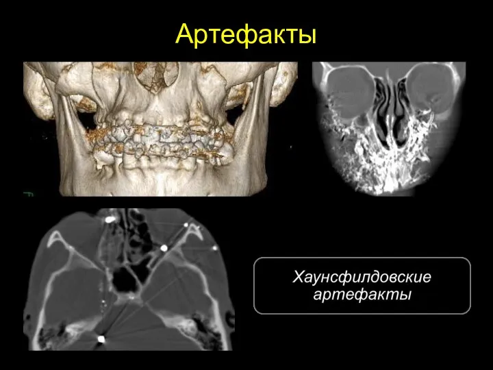 Артефакты