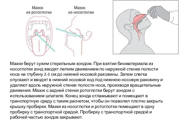 Мазки берут сухим стерильным зондом. При взятии биоматериала из носоглотки зонд