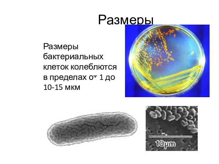 Размеры Размеры бактериальных клеток колеблются в пределах от 1 до 10-15 мкм