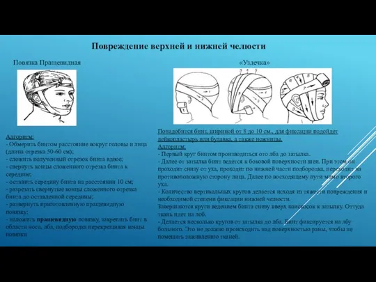 Повреждение верхней и нижней челюсти Повязка Пращевидная «Уздечка» Алгоритм: - Обмерить