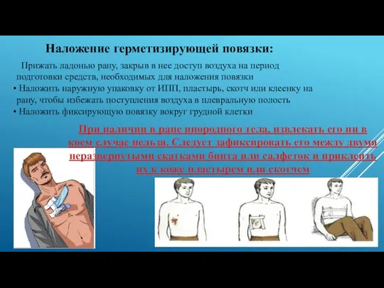 Наложение герметизирующей повязки: Прижать ладонью рану, закрыв в нее доступ воздуха