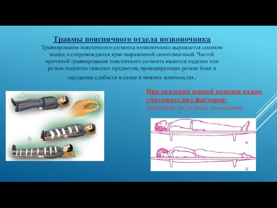 Травмы поясничного отдела позвоночника Травмирование поясничного сегмента позвоночника выражается спазмом мышц