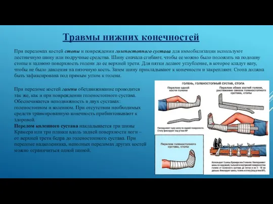 Травмы нижних конечностей При переломах костей стопы и повреждении голеностопного сустава