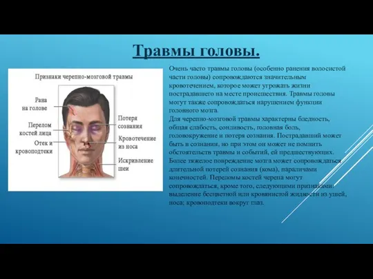 Травмы головы. Очень часто травмы головы (особенно ранения волосистой части головы)