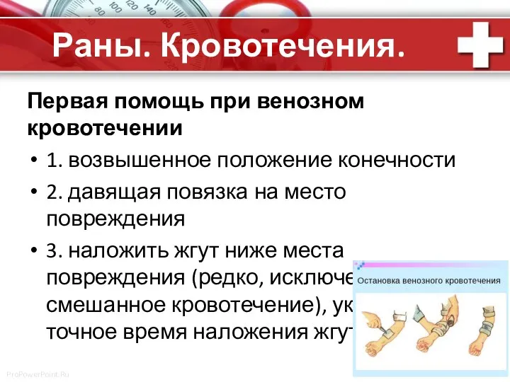 Раны. Кровотечения. Первая помощь при венозном кровотечении 1. возвышенное положение конечности