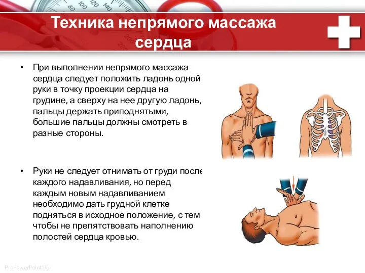 Техника непрямого массажа сердца При выполнении непрямого массажа сердца следует положить