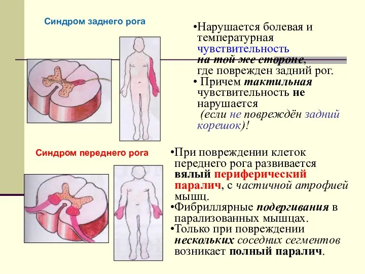 Нарушается болевая и температурная чувствительность на той же стороне, где поврежден