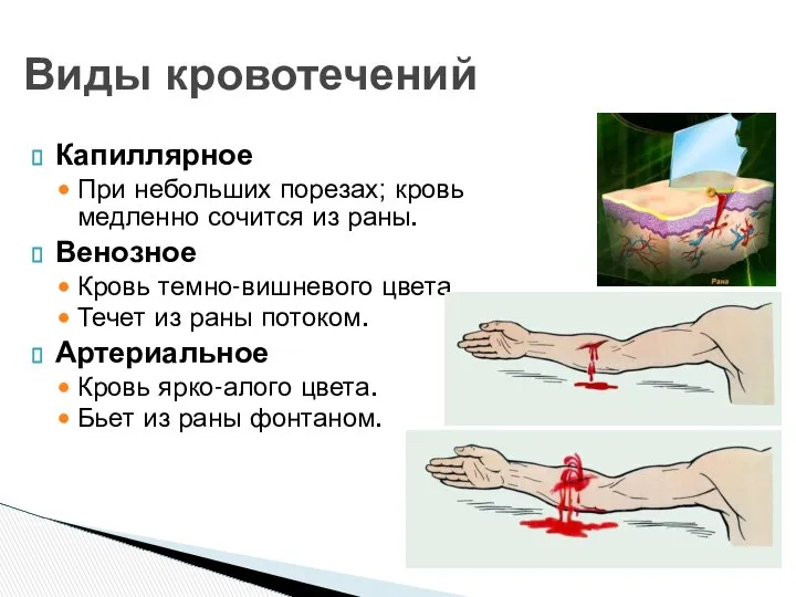 Капиллярное При небольших порезах; кровь медленно сочится из раны. Венозное Кровь