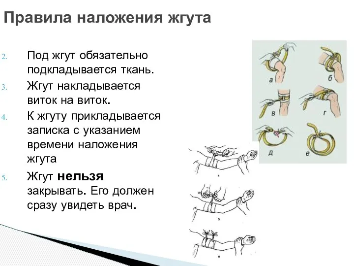 Правила наложения жгута Под жгут обязательно подкладывается ткань. Жгут накладывается виток