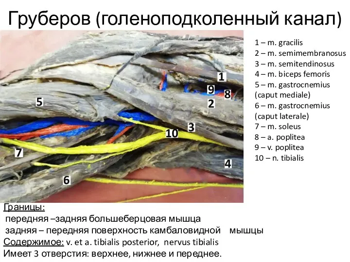 Груберов (голеноподколенный канал) 1 – m. gracilis 2 – m. semimembranosus