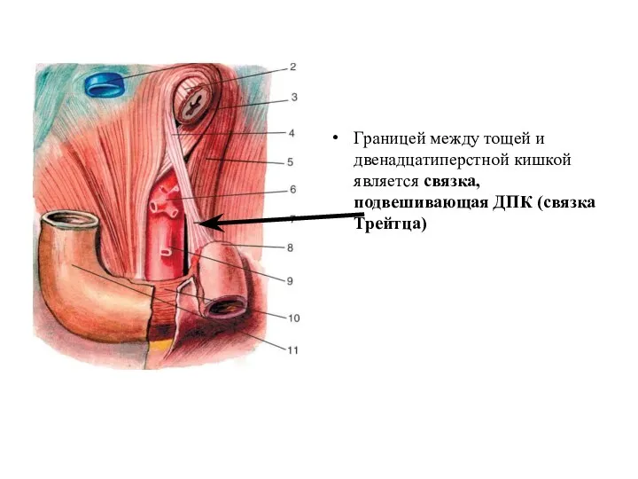 Границей между тощей и двенадцатиперстной кишкой является связка, подвешивающая ДПК (связка Трейтца)