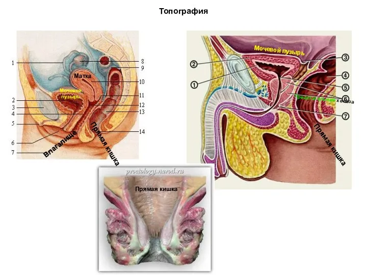 Топография Прямая кишка Прямая кишка Прямая кишка Матка Мочевой пузырь Влагалище Мочевой пузырь Предстательная железа