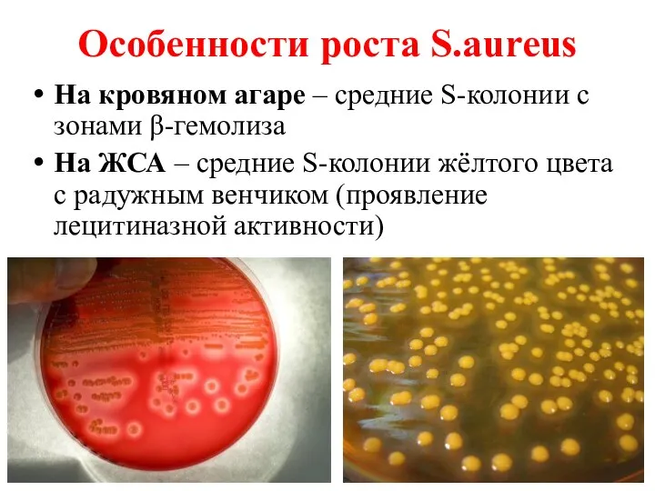 Особенности роста S.aureus На кровяном агаре – средние S-колонии с зонами